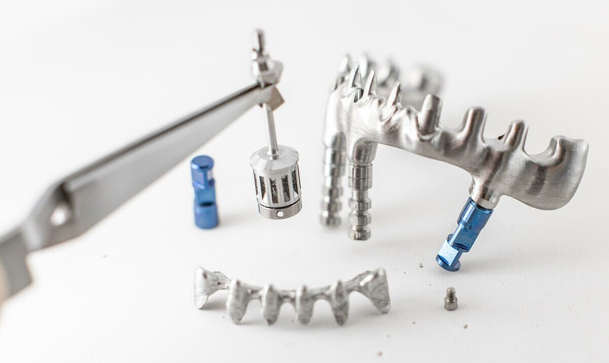 Implantes dentales subperiósticos en Donostia